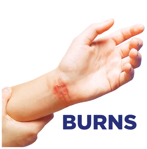 soframycin skin cream 30 gm